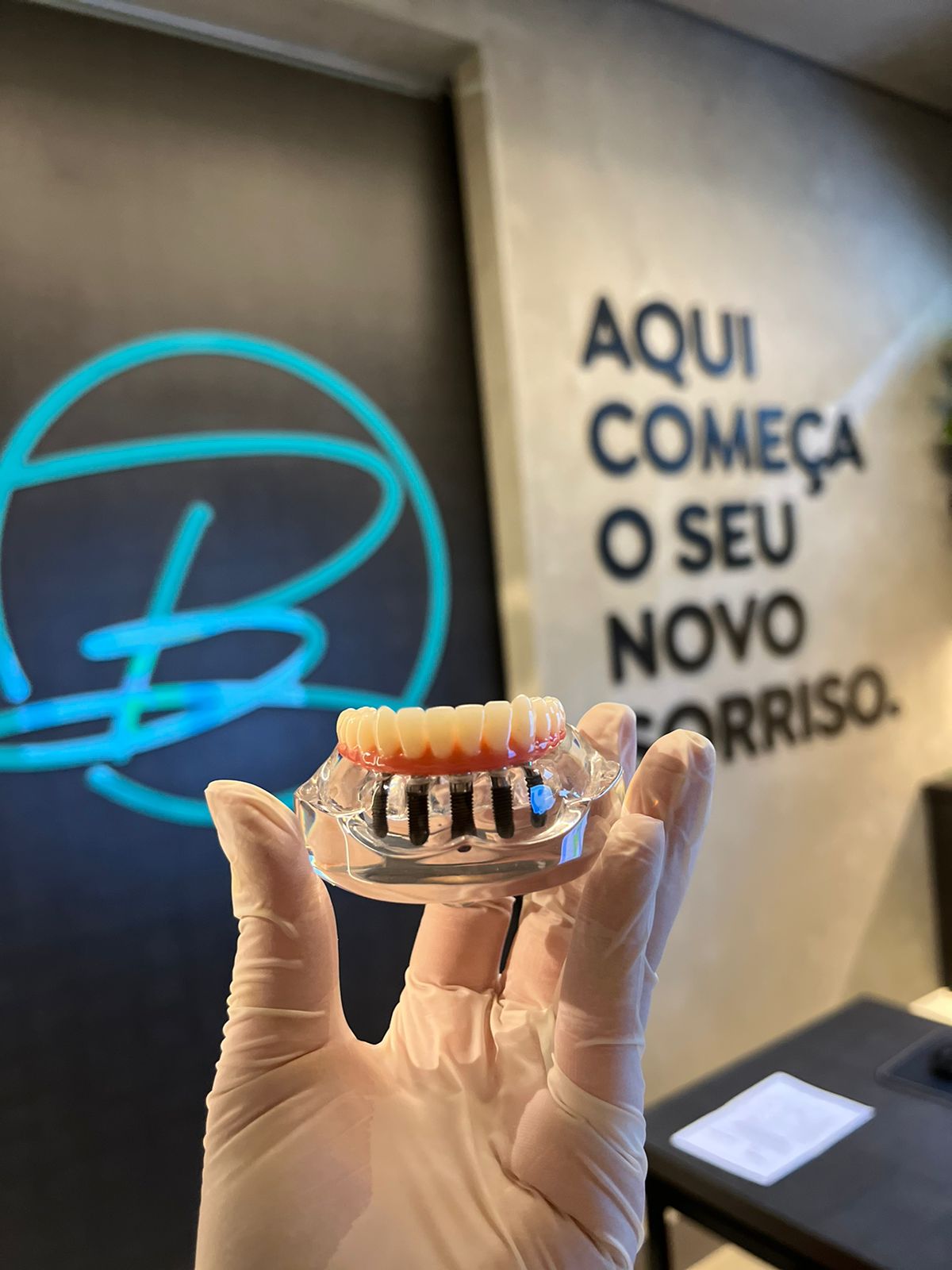 Modelo de Prótese Protocolo sendo segurado na Bongiovanni